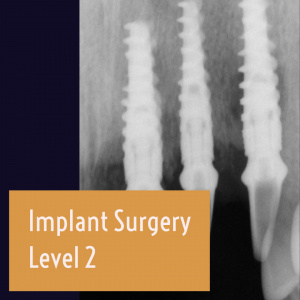 implant 2