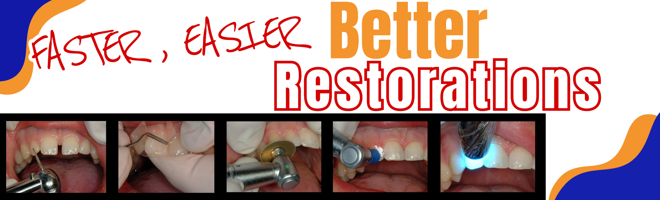 Faster, Easier, Better Restorations