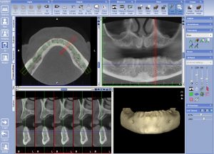 Implementing Cone Beam CT Imaging into Your Practice - V1174